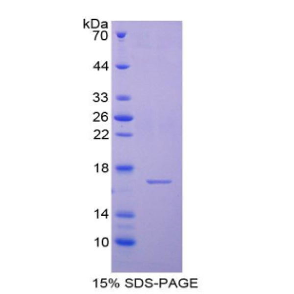 半胱氨酸蛋白酶抑制剂6(CST6)重组蛋白(多属种)