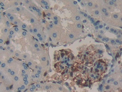 肾足蛋白(NPHN)多克隆抗体