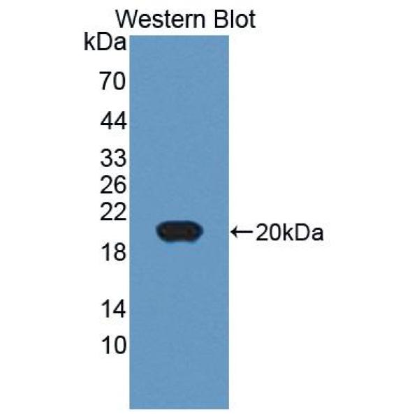 低密度脂蛋白受体(LDLR)多克隆抗体