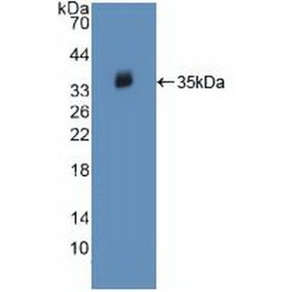 尼克酰胺腺嘌呤二核苷酸磷酸氧化酶3(NOX3)多克隆抗体