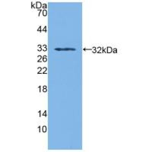 液泡蛋白分拣蛋白13D(VPS13D)多克隆抗体