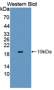 白介素23&#945;(IL23a)多克隆抗体