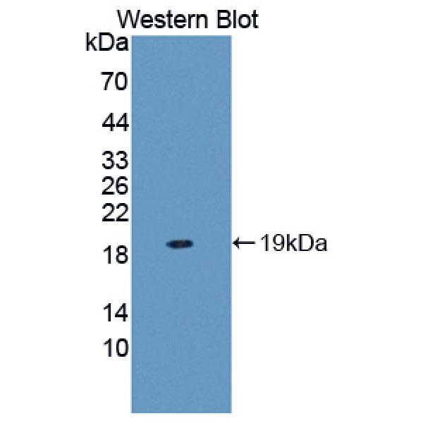 白介素23α(IL23a)多克隆抗体
