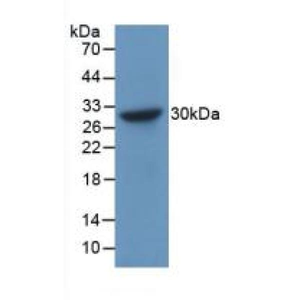 M2-型丙酮酸激酶(PKM2)多克隆抗体