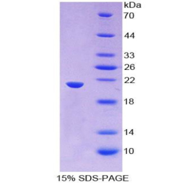 血清/糖皮质激素调节激酶2(SGK2)重组蛋白(多属种)