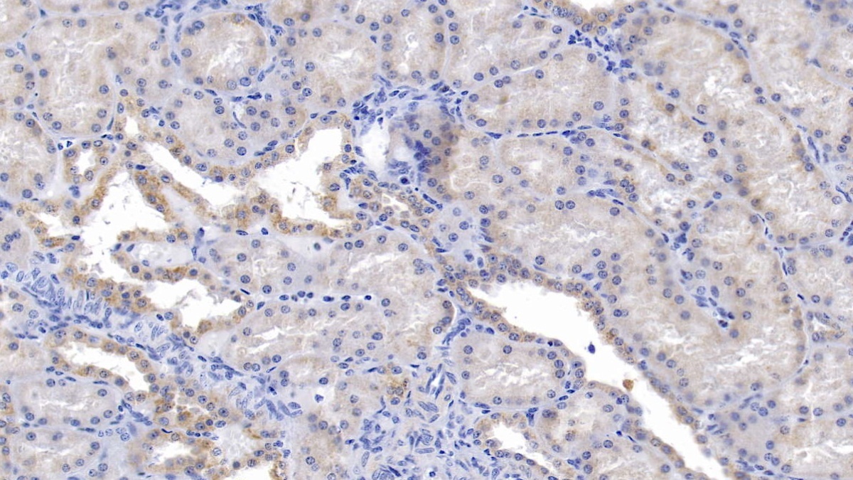 细胞程序性死亡蛋白1(PD1)多克隆抗体
