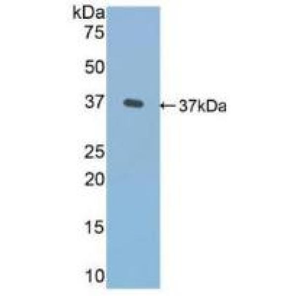 序列相似家族3成员B(FAM3B)多克隆抗体