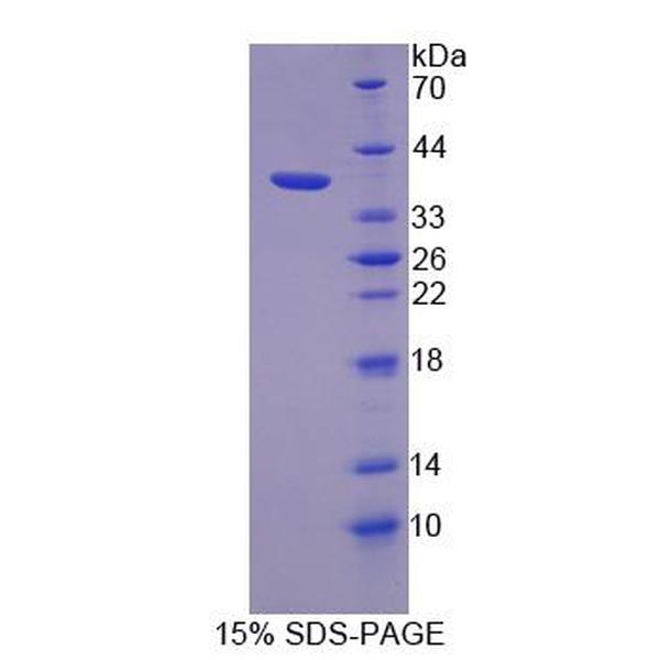 蛋白激酶D3(PKD3)重组蛋白(多属种)