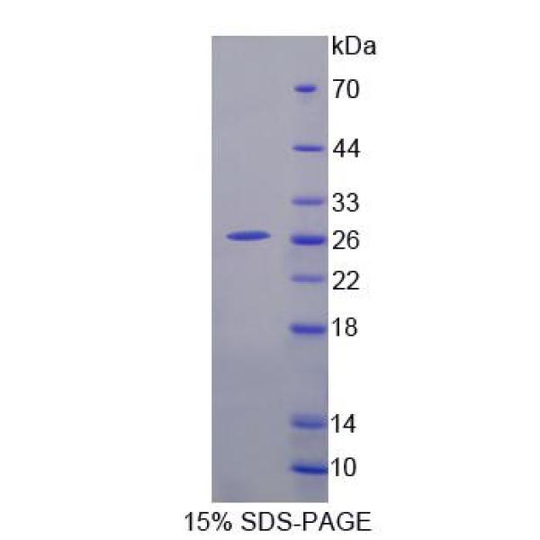 血小板反应蛋白解整合素金属肽酶9(ADAMTS9)重组蛋白(多属种)
