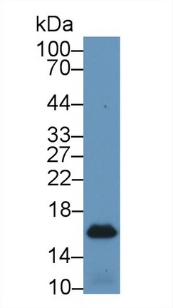角蛋白25(KRT25)多克隆抗体