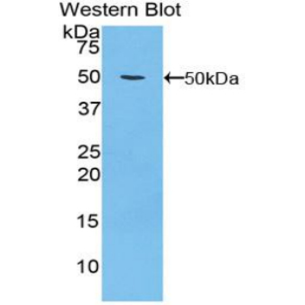 性激素结合球蛋白(SHBG)多克隆抗体