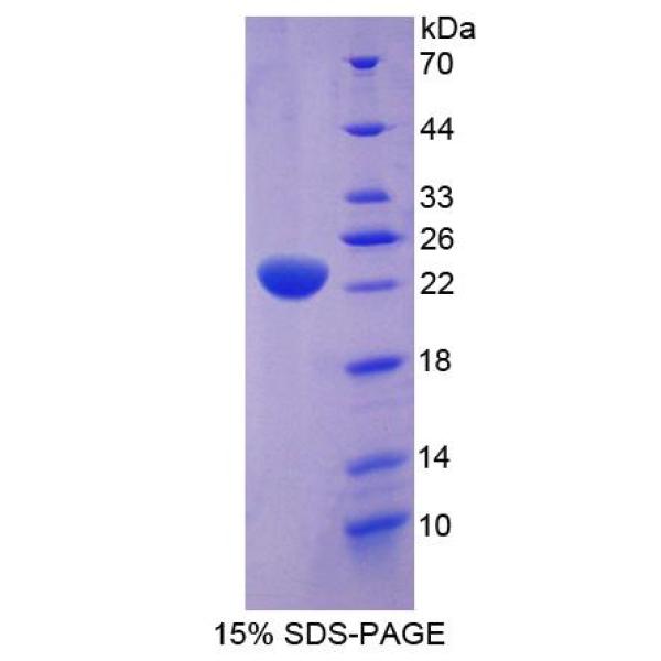 己糖激酶3(HK3)重组蛋白(多属种)