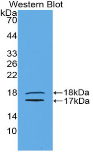 足突蛋白(PDCN)多克隆抗体