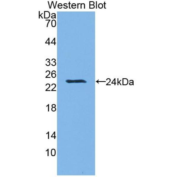 颗粒酶B(GZMB)多克隆抗体