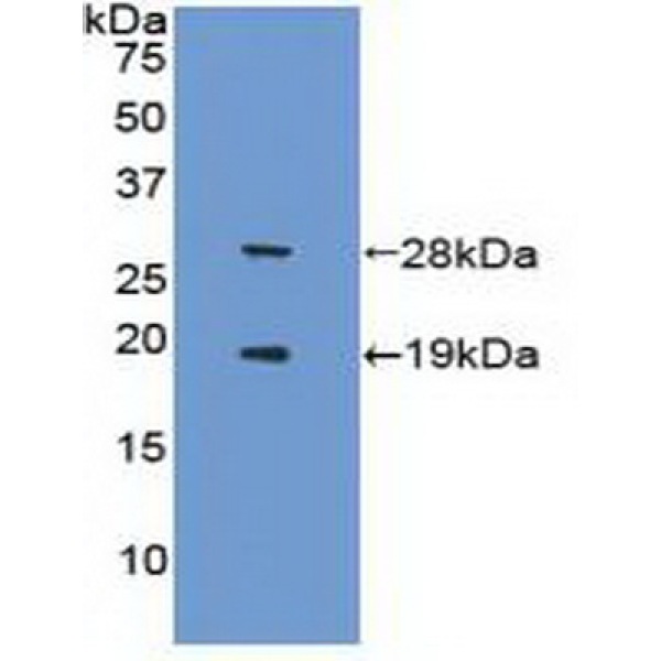 Nei内切核酸酶Ⅷ样蛋白3(NEIL3)多克隆抗体