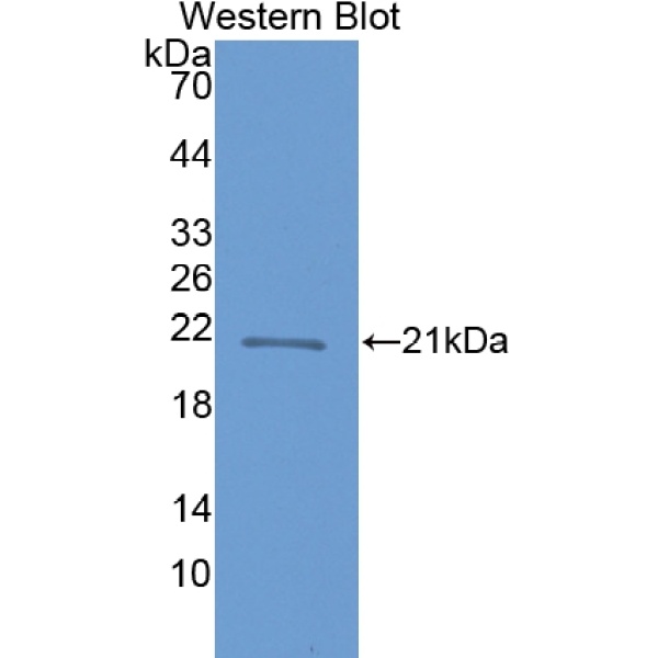 亮氨酸丰富重复免疫球蛋白样域蛋白3(LRIG3)多克隆抗体