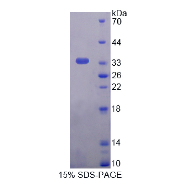 白介素26(IL26)重组蛋白(多属种)