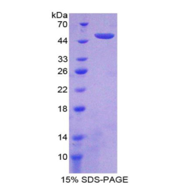 组蛋白脱乙酰基酶9(HDAC9)重组蛋白(多属种)
