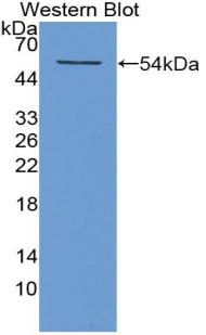 角蛋白12(CK12)多克隆抗体