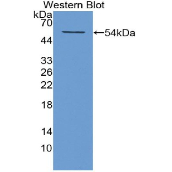 角蛋白12(CK12)多克隆抗体