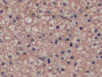 癌胚抗原(CEA)多克隆抗体
