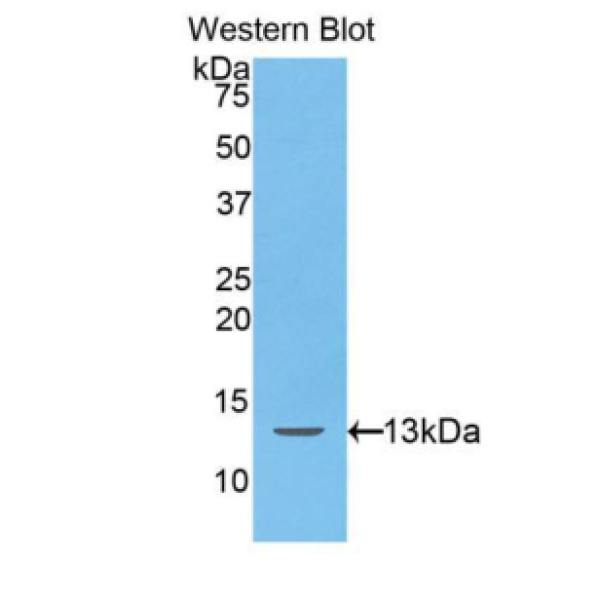 血小板衍生生长因子AA(PDGFAA)多克隆抗体