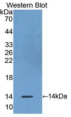 非转移细胞5表达NM23A蛋白(NME5)多克隆抗体