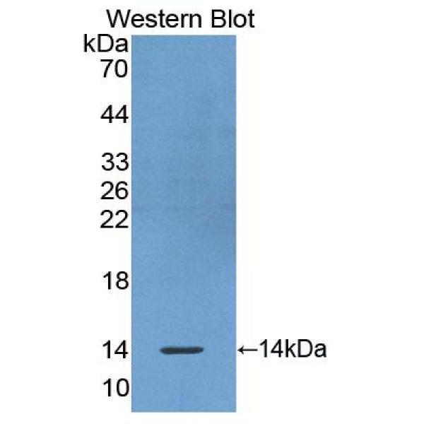 非转移细胞5表达NM23A蛋白(NME5)多克隆抗体