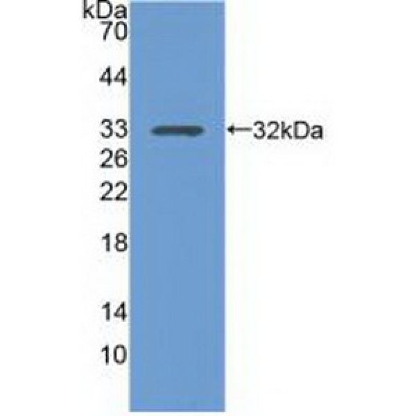 角蛋白15(KRT15)多克隆抗体