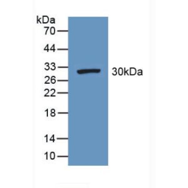 无补缀同源物1(DISP1)多克隆抗体