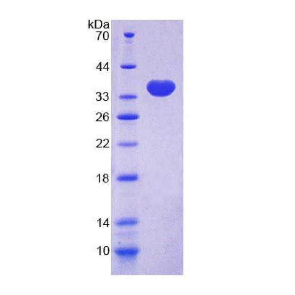 CD52分子(CD52)重组蛋白(多属种)