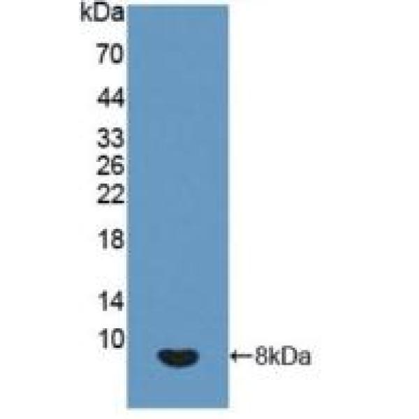 激肽释放酶6(KLK6)多克隆抗体