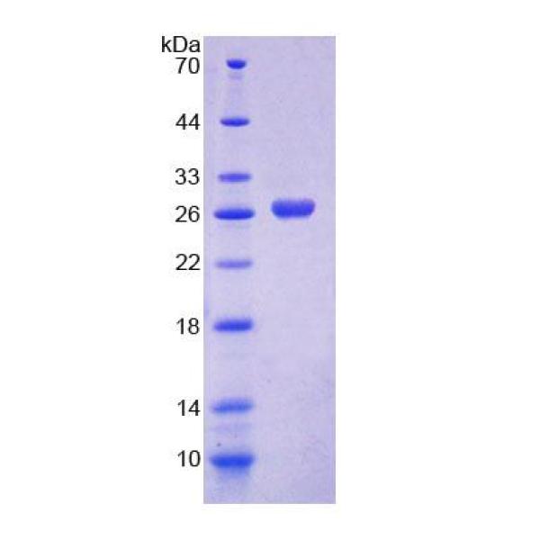 Ras GTP酶激活蛋白1(RASA1)重组蛋白(多属种)