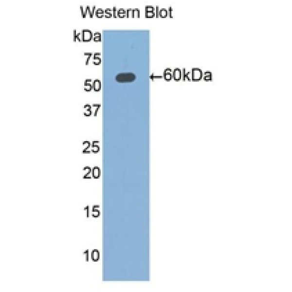 角蛋白2(CK2)多克隆抗体