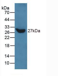 基质金属蛋白酶11(MMP11)多克隆抗体