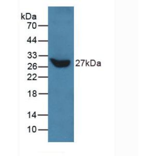 基质金属蛋白酶11(MMP11)多克隆抗体
