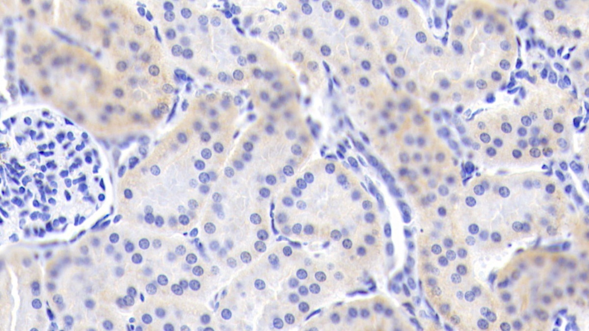 髓样前体细胞抑制因子2(MPIF2)多克隆抗体