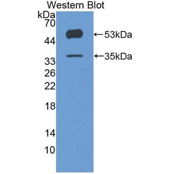 C组着色性干皮病偶联因子(XPC)多克隆抗体