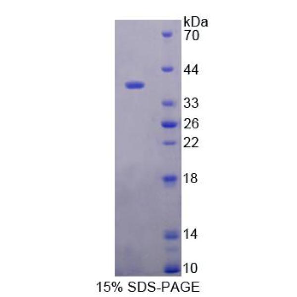 胎盘蛋白13(PP13)重组蛋白(多属种)