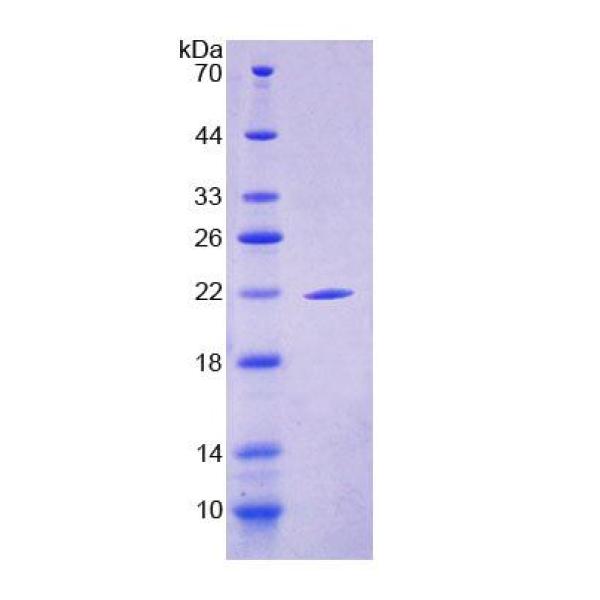 吞噬/细胞运动因子2(ELMO2)重组蛋白(多属种)