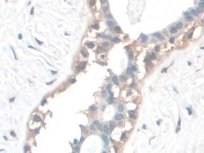 微管关联蛋白1A(MAP1A)多克隆抗体