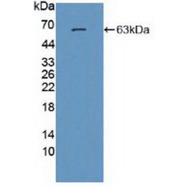 核糖核酸酶T2(RNASET2)多克隆抗体