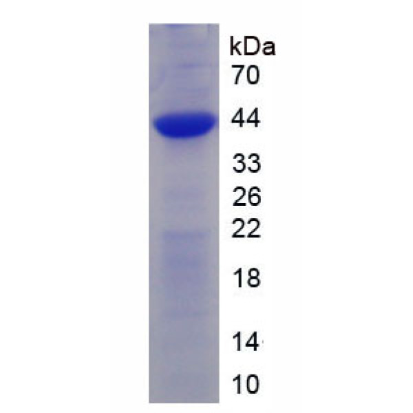 桥粒芯胶粘蛋白1(DSC1)重组蛋白(多属种)