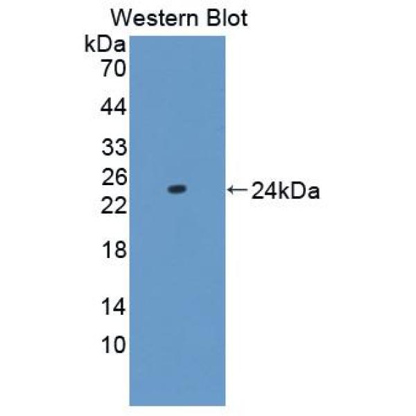 Runt相关转录因子3(RUNX3)多克隆抗体