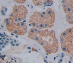 巨噬细胞集落刺激因子(MCSF)多克隆抗体