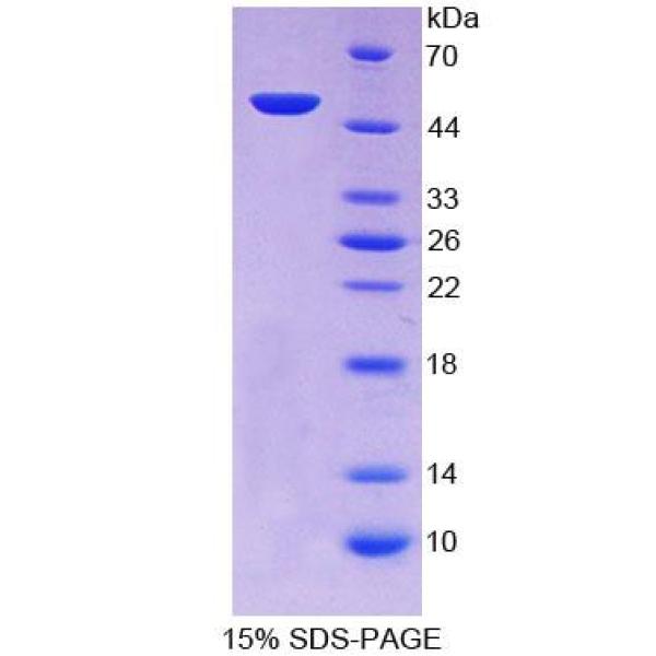 基质金属蛋白酶26(MMP26)重组蛋白(多属种)