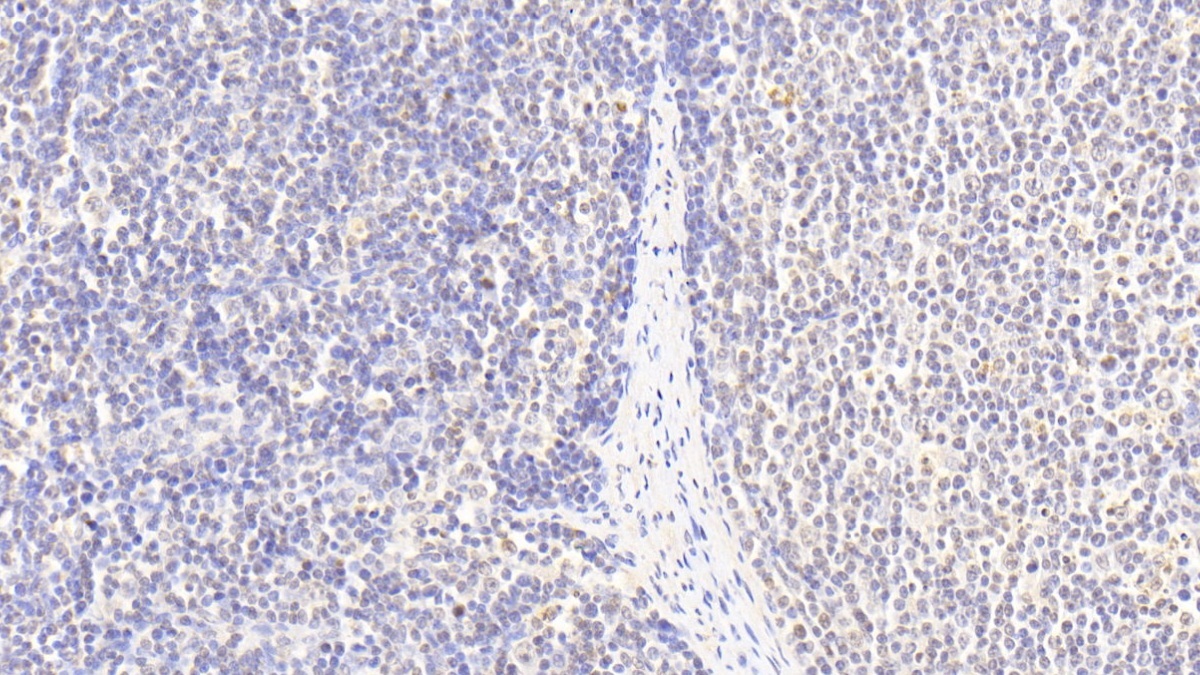 叉头框蛋白M1(FOXM1)多克隆抗体