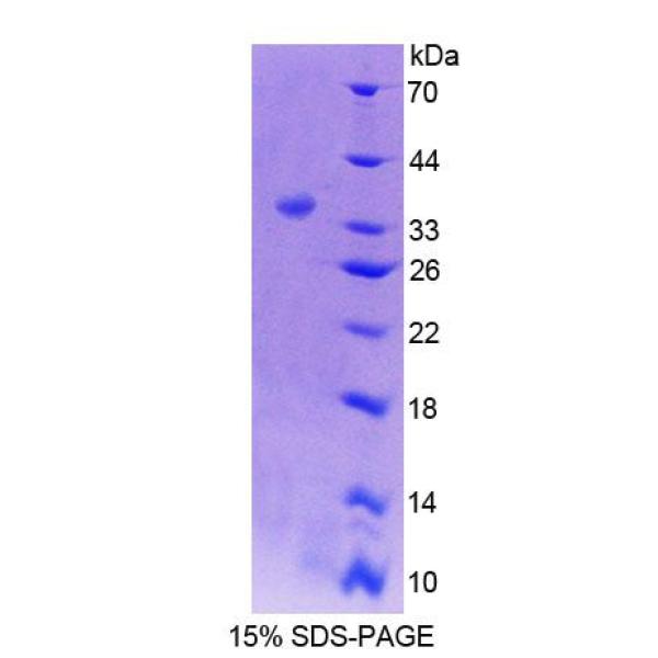 自然细胞毒性触发受体2(NCR2)重组蛋白(多属种)