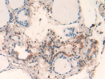 干扰素&#945;4(IFNa4)多克隆抗体