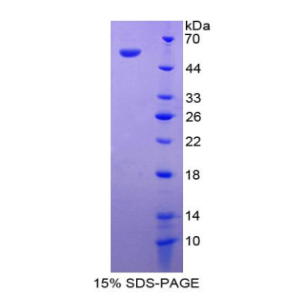 细胞死亡诱导DFFA样效应蛋白A(CIDEA)重组蛋白(多属种)